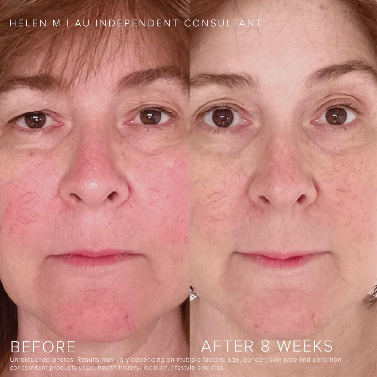 Rodan + Fields Soothe Daily Mineral Sunscreen SPF 30 | 1 Fl Oz | SPF Moisturizer for Face | Zinc