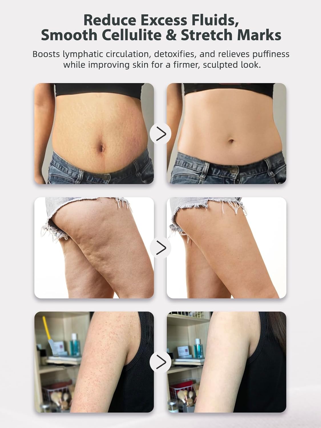 Lymphatic Drainage Massager & Anti Cellulite Massage Tool, Helps Reduce Stretch Marks & Cellulite