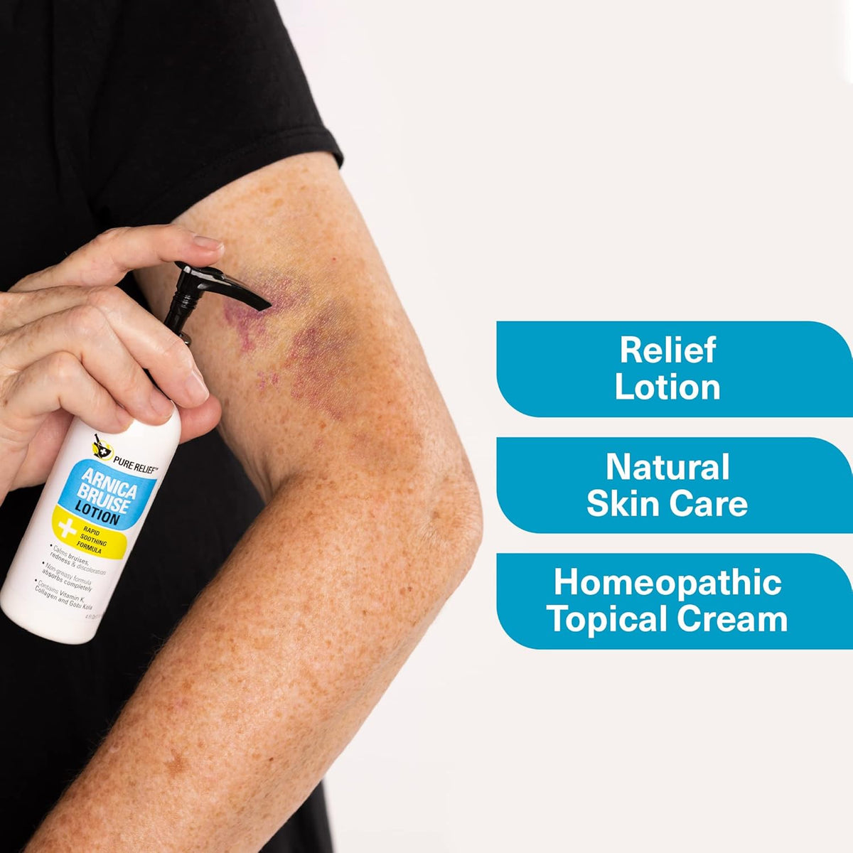 Arnica Bruise Relief Lotion for Bruising, Swelling, & Discoloration On Skin, Natural Skin Care