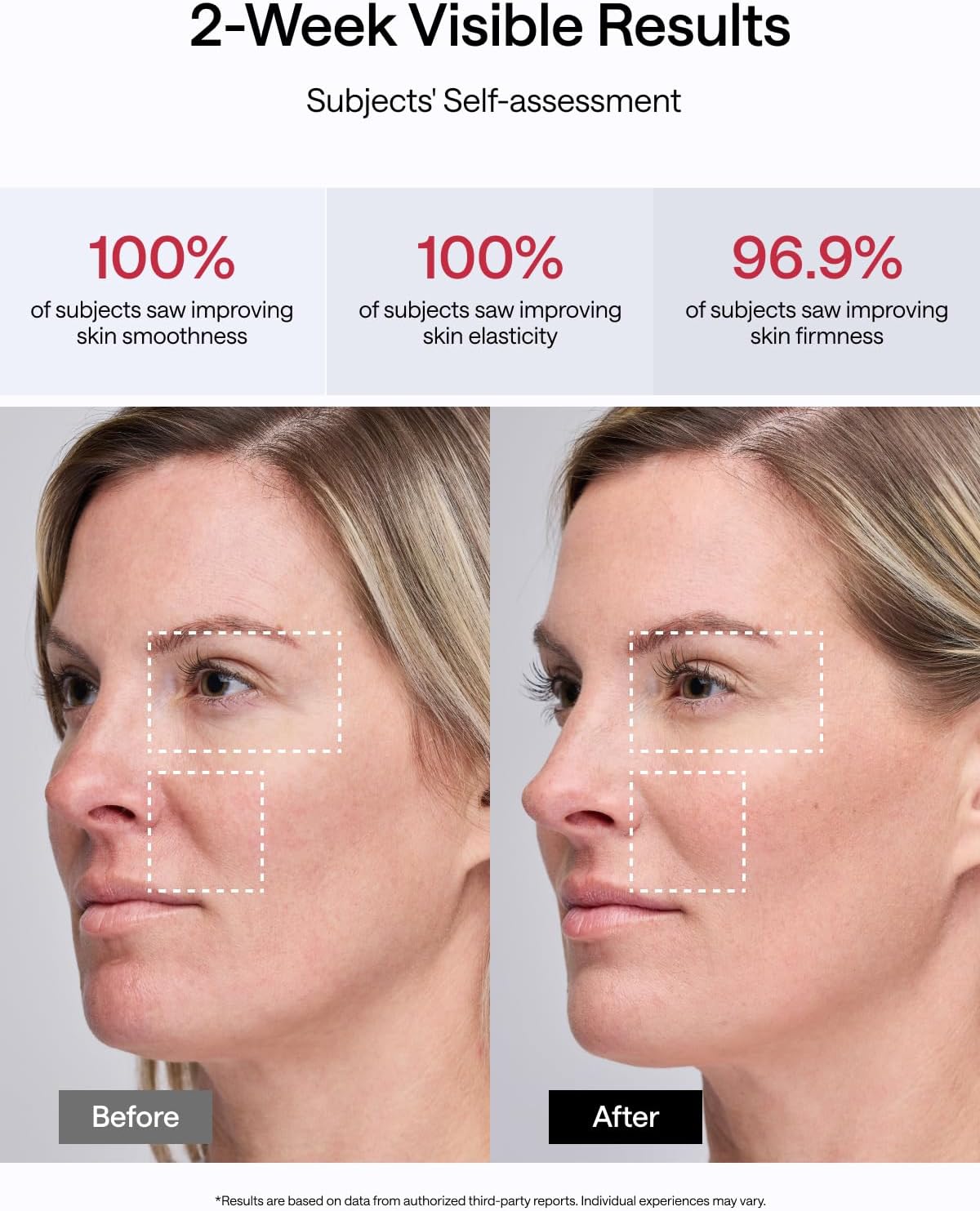 JMOON NouvelleSkin Facial Toning Device, FDA-Cleared Microcurrent Facial Device and Red Light