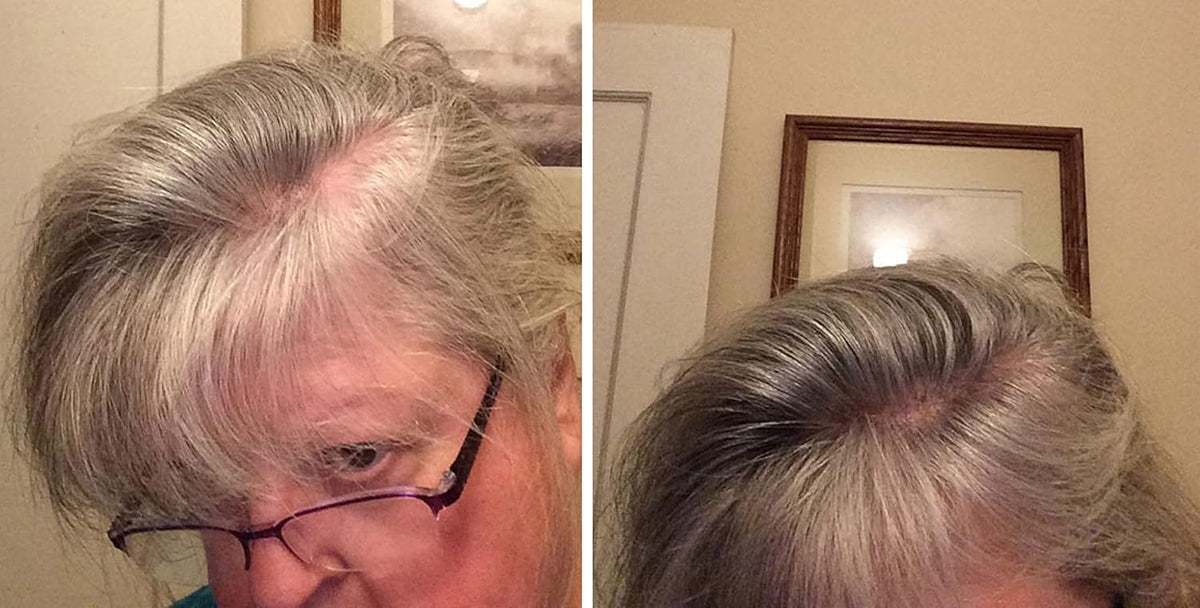 Caboki Hair Loss Concealer. All-Natural Hair Building Fiber. Make Thin Hair Look 10X Fuller