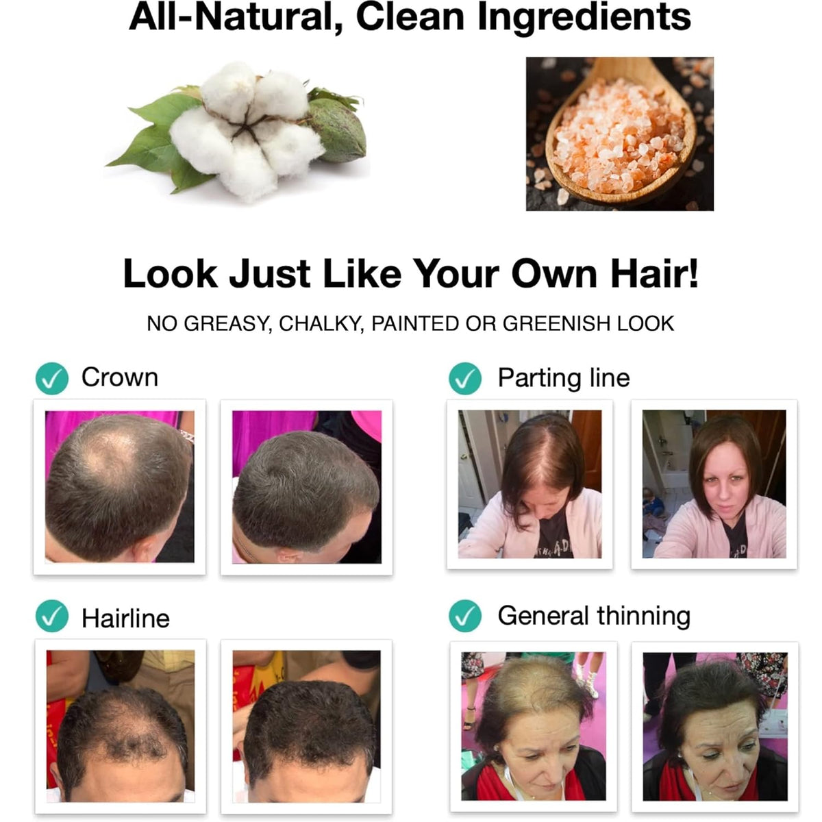 Caboki Hair Loss Concealer. All-Natural, Plant-Based Hair Building Fiber. Covers Bald Spot and