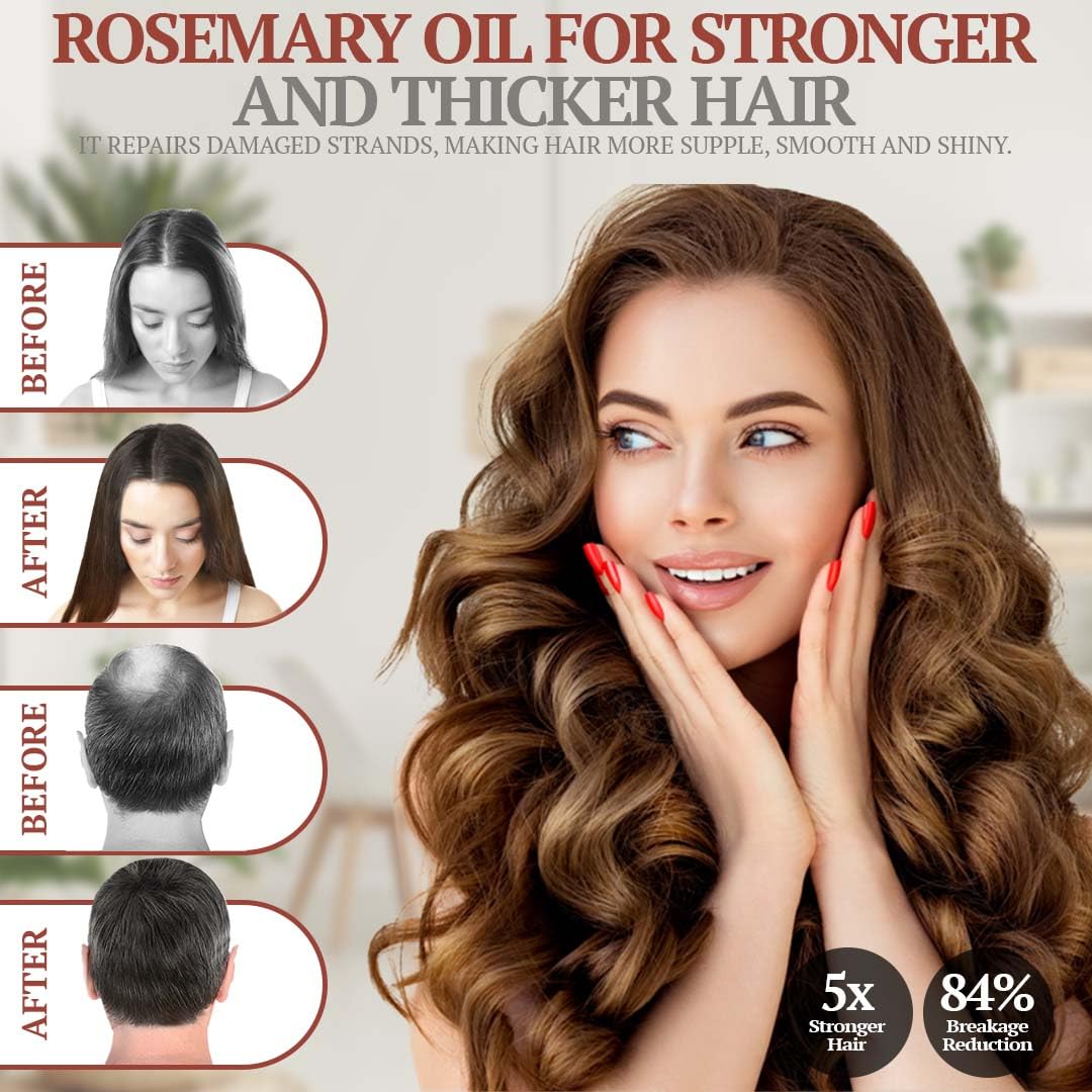 100% Pure Rosemary Oil for Hair Growth, Infused with Biotin, Jojoba & castor Oils - Natural Hair