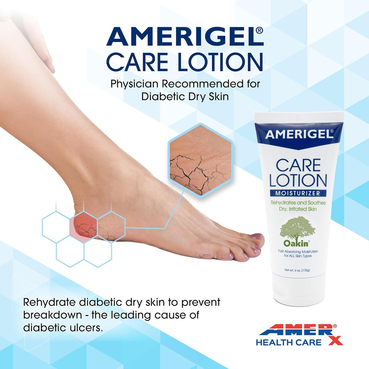 AMERIGEL Care Lotion – Hypoallergenic Moisturizer - Diabetic Skin Care - Rehydrates and Soothes