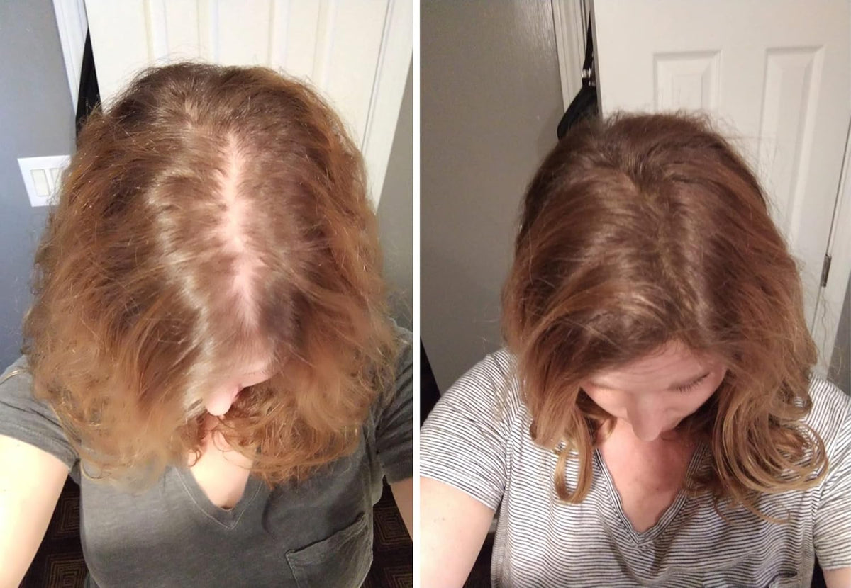 Caboki All-Natural Hair Building Fiber. Make Thin Hair Look 10X Fuller Instantly. Eliminate the