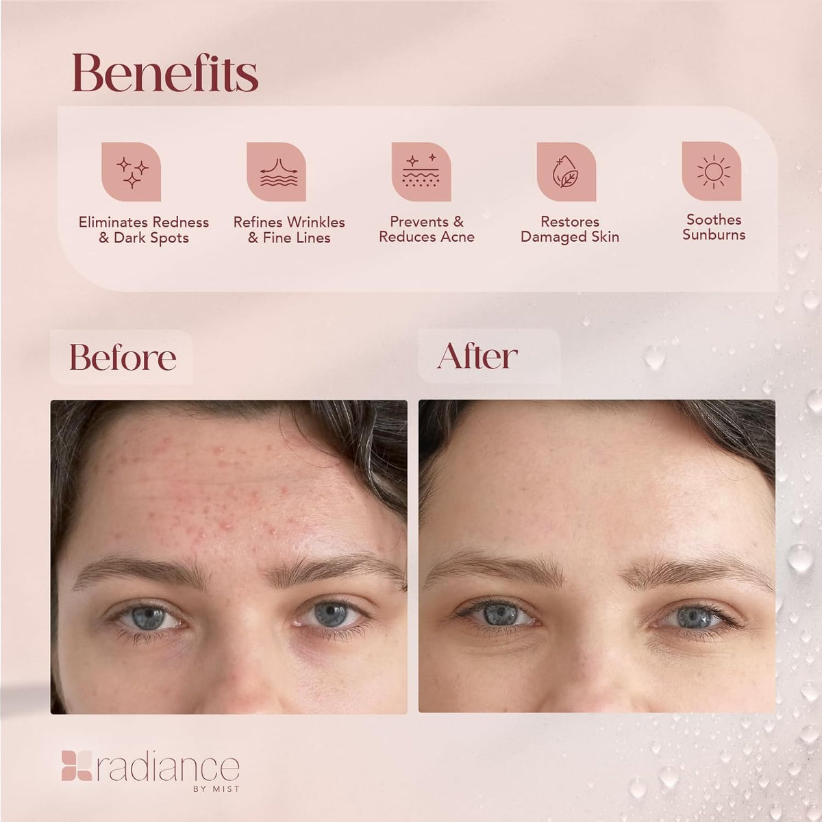 Radiance Snail Mucin Serum with Advanced Snail 96% Mucin Power Essence, Korean Skin Care with