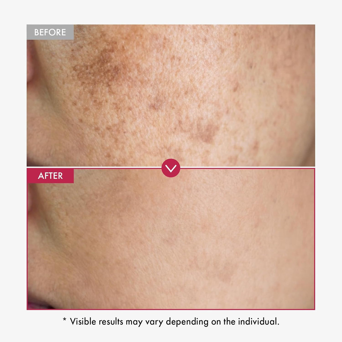 Niacinamide 10% + Tranexamic Acid 4% Serum, Arbutin 2%, Hyaluronic Acid, TXA Facial Serum, Glass