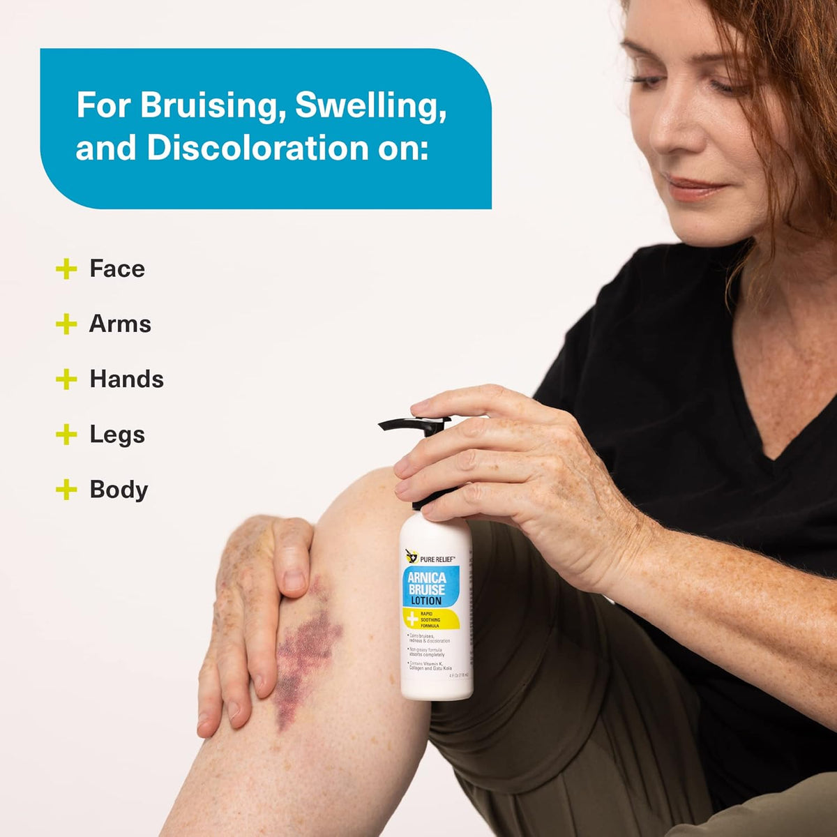 Arnica Cream Bruise Relief Lotion for Bruising and Swelling On Skin | Bruise Cream Extra Strength