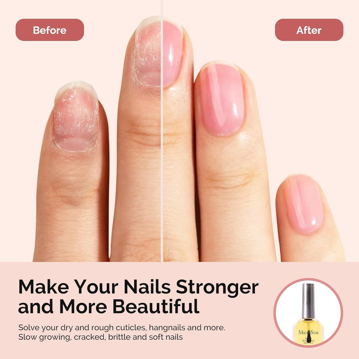 MelodySusie No Wipe Glossy Top Coat Base Coat Cuticle Oil Set Long Lasting Shine Finish Soak Off UV
