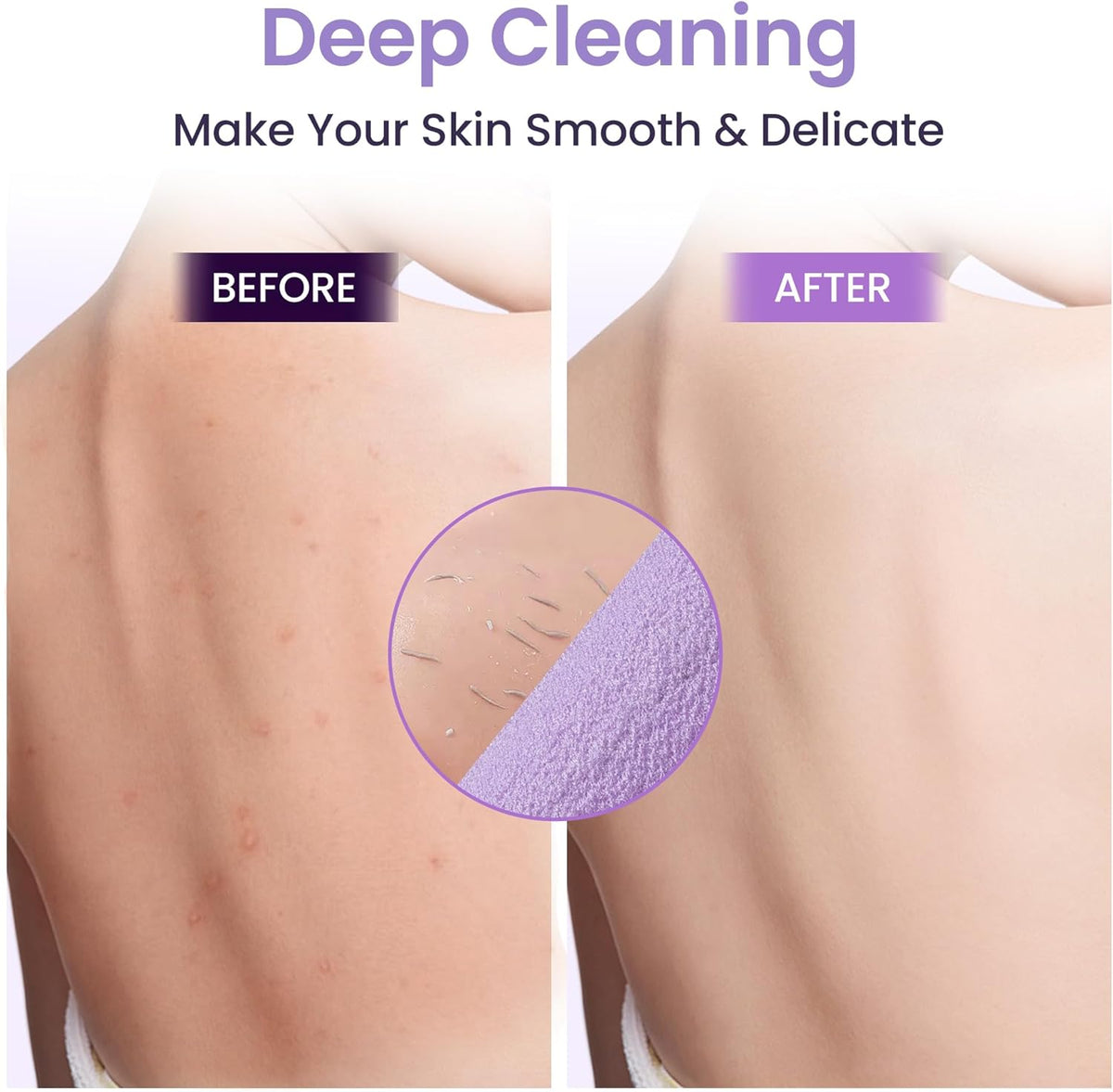 3 Pcs Double-Sided Back Exfoliator Body Scrub Towel, Exfoliating Back Scrubber with
