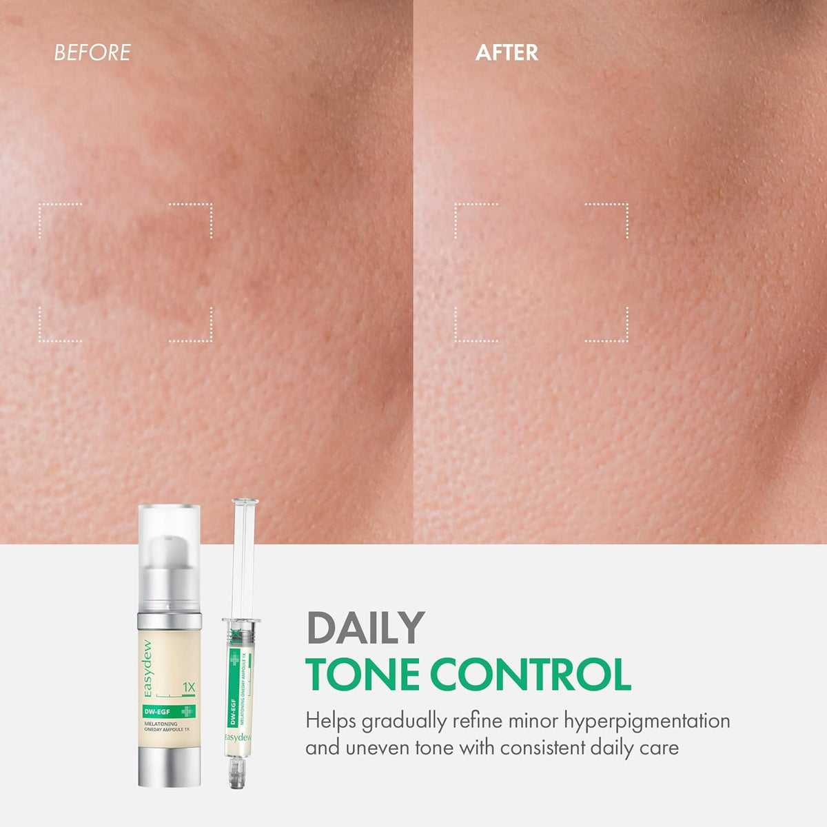 Easydew DW-EGF Melatoning Ampoule 1X - Hydrating Dark Spot Serum with Niacinamide & Glutathione for