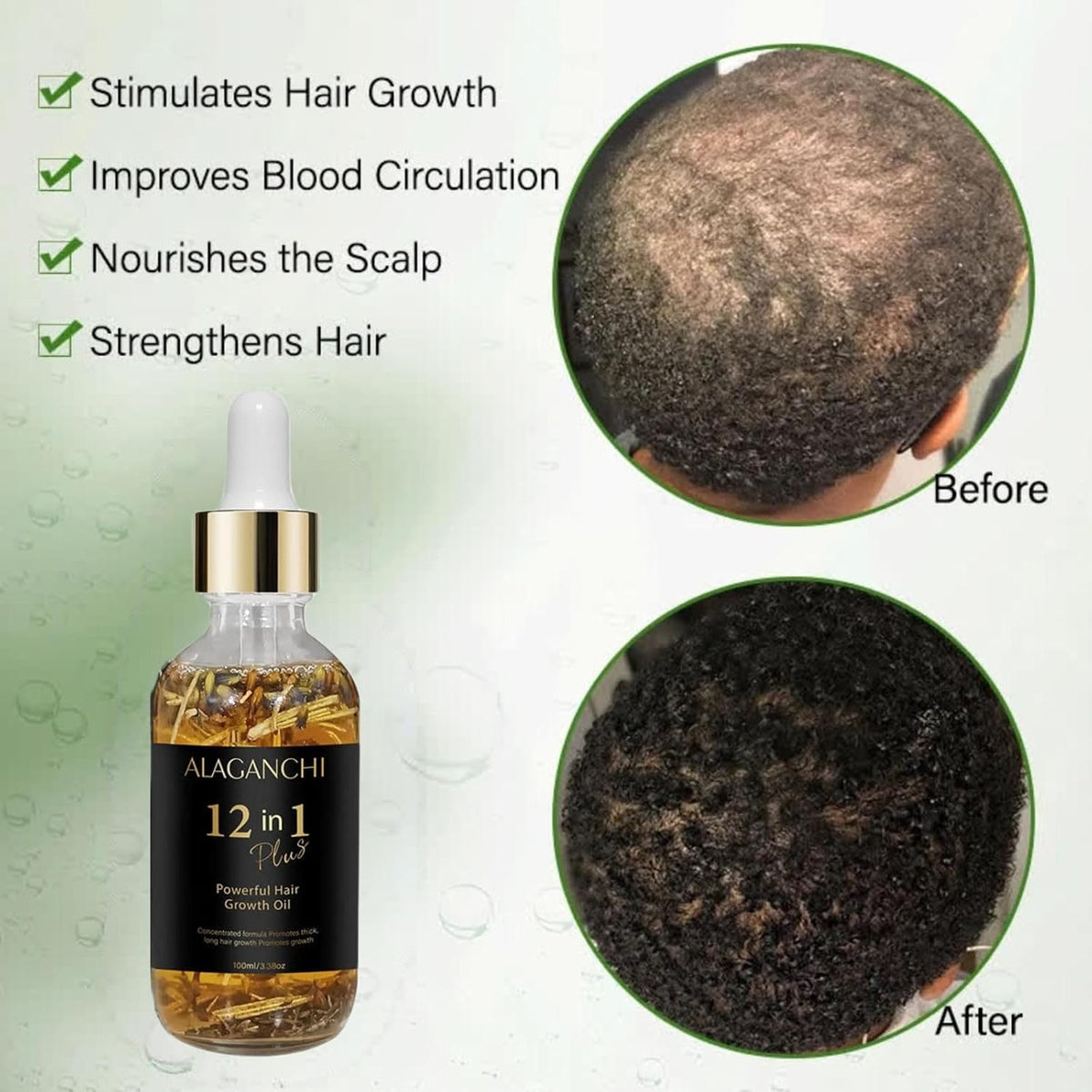 12-in-1 Hair Growth Oil – Rosemary, Amla & Castor Oil | Strengthens, Nourishes, Reduces Hair Fall |