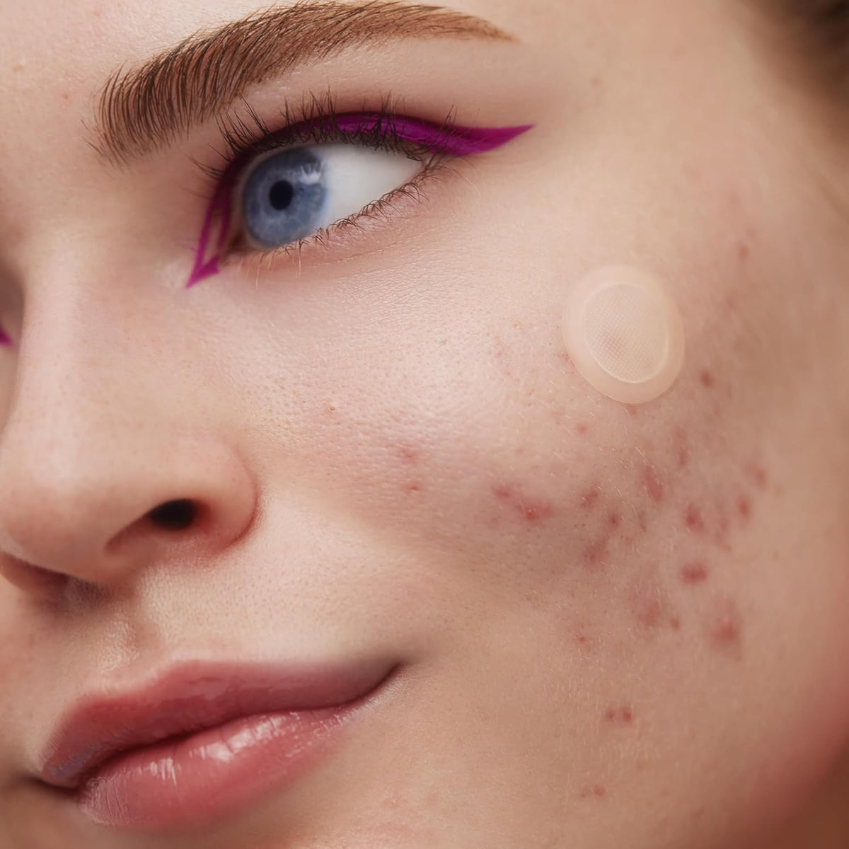 PEACE OUT Early Stage Acne Dots Helps Target Blemishes Below the Surface, Hydrocolloid Pimple
