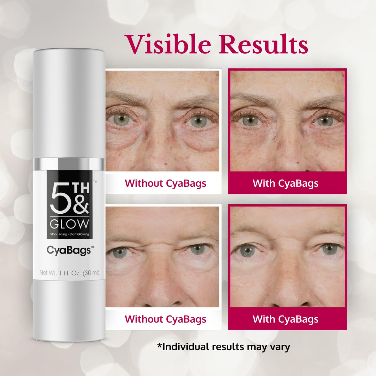 5th & Glow Cyabags - Instant Under Eye Bag Remover Serum For Dark Circles & Puffy Eyes Reduction