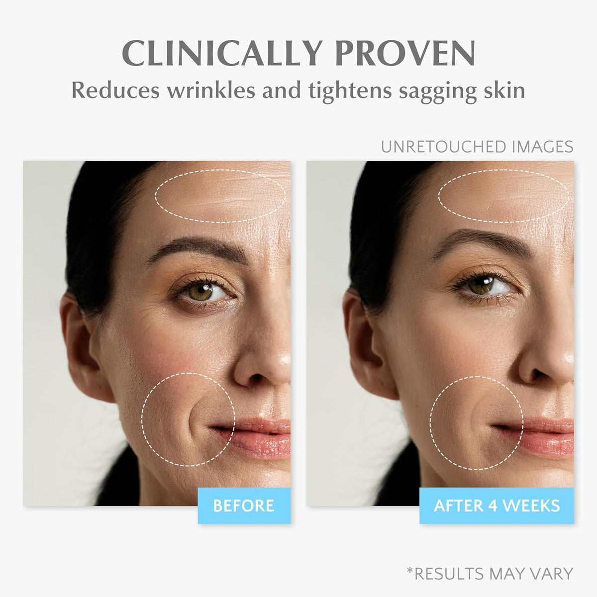 Retinol Anti Aging Face Moisturizer: Wrinkle Cream for Women, Collagen Day Night Repair Cream