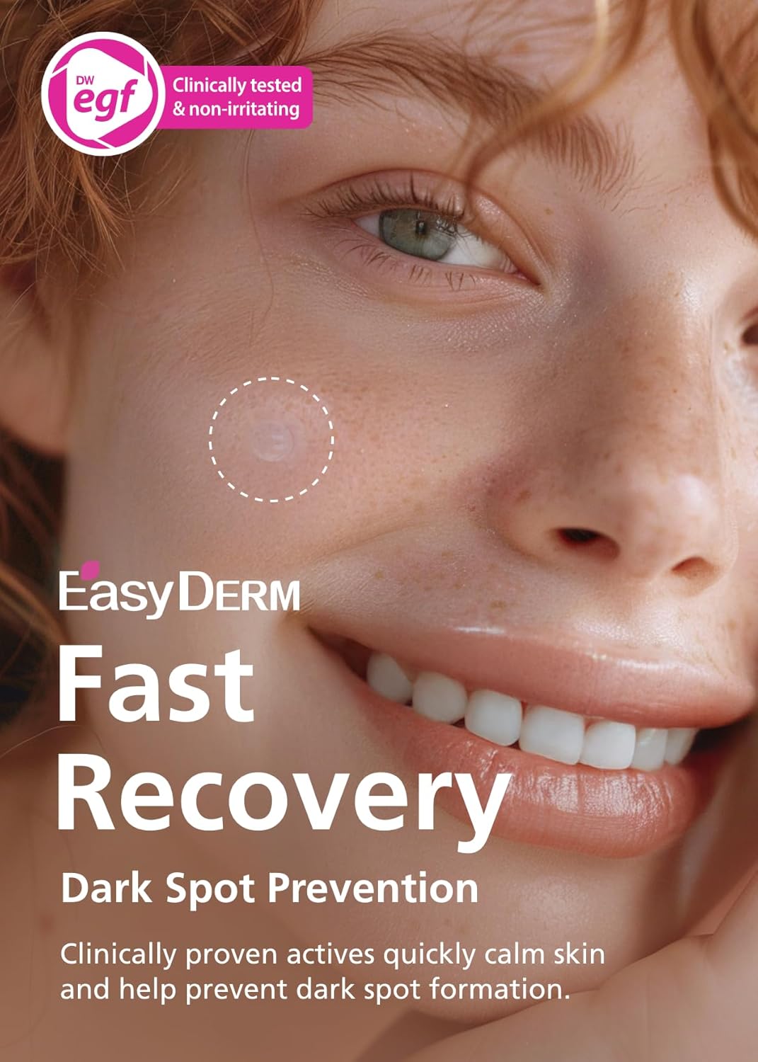 EasyDerm Real Calming Microdart Pimple Patches, Clear Micropoint | Niacinamide, Hyaluronic Acid