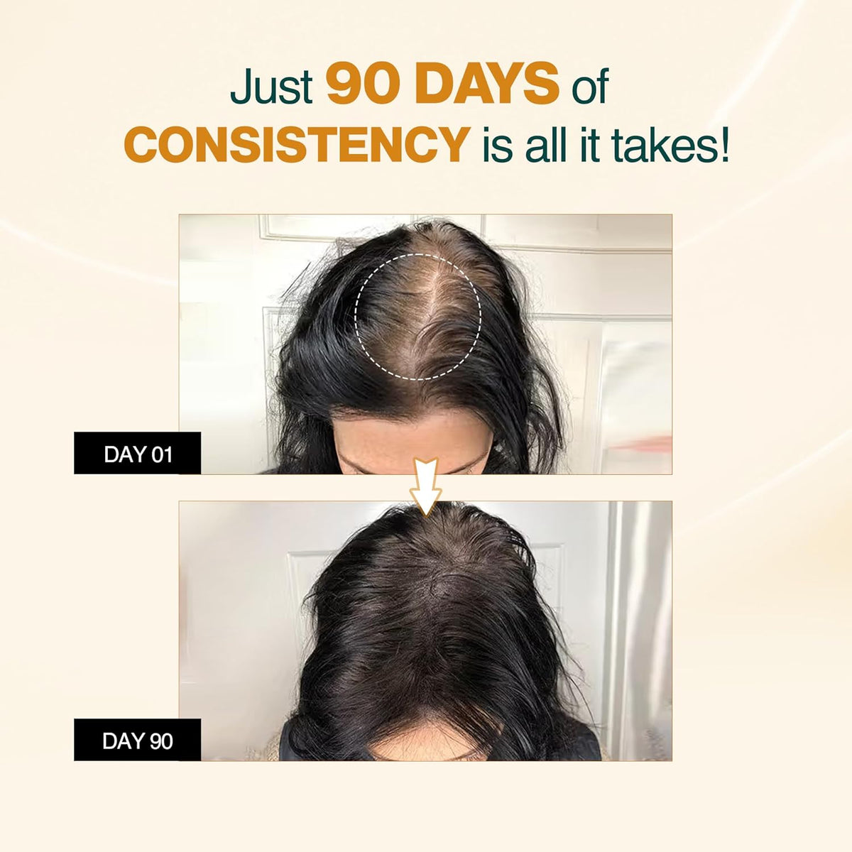 Nourish Mantra Advanced Hair Growth Serum 50ml, 3% Redensyl, 2% Anagain, 2% Procapil, 5% Rice