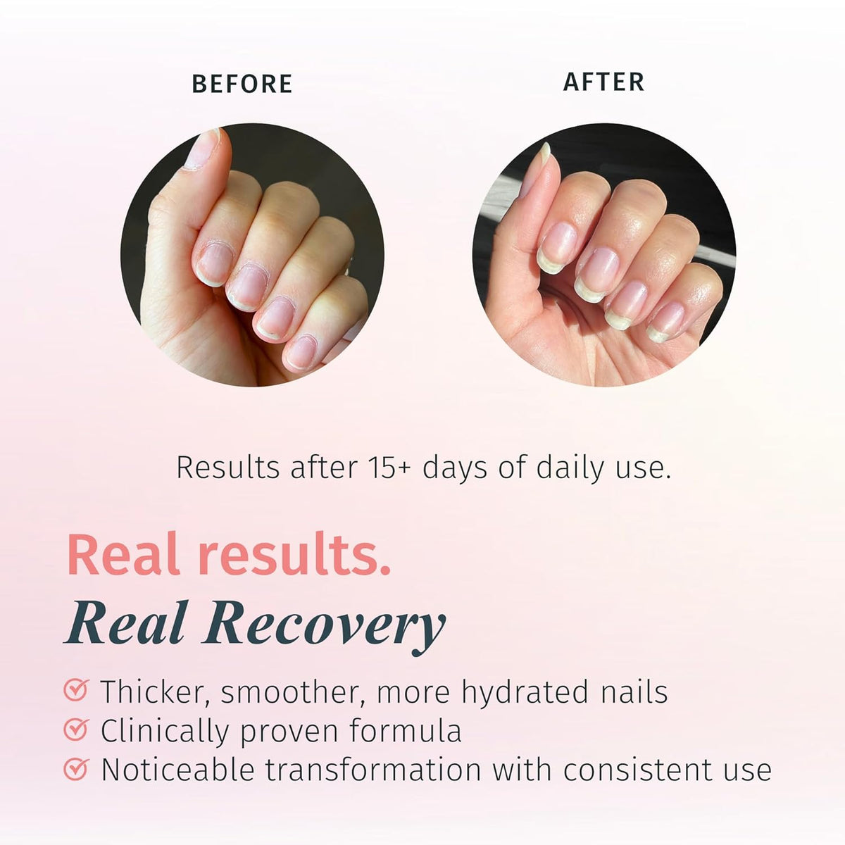 duri Rejuvacote 1 Original Maximum Strength Nail Growth System Base, Top Coat - Nails Hardening
