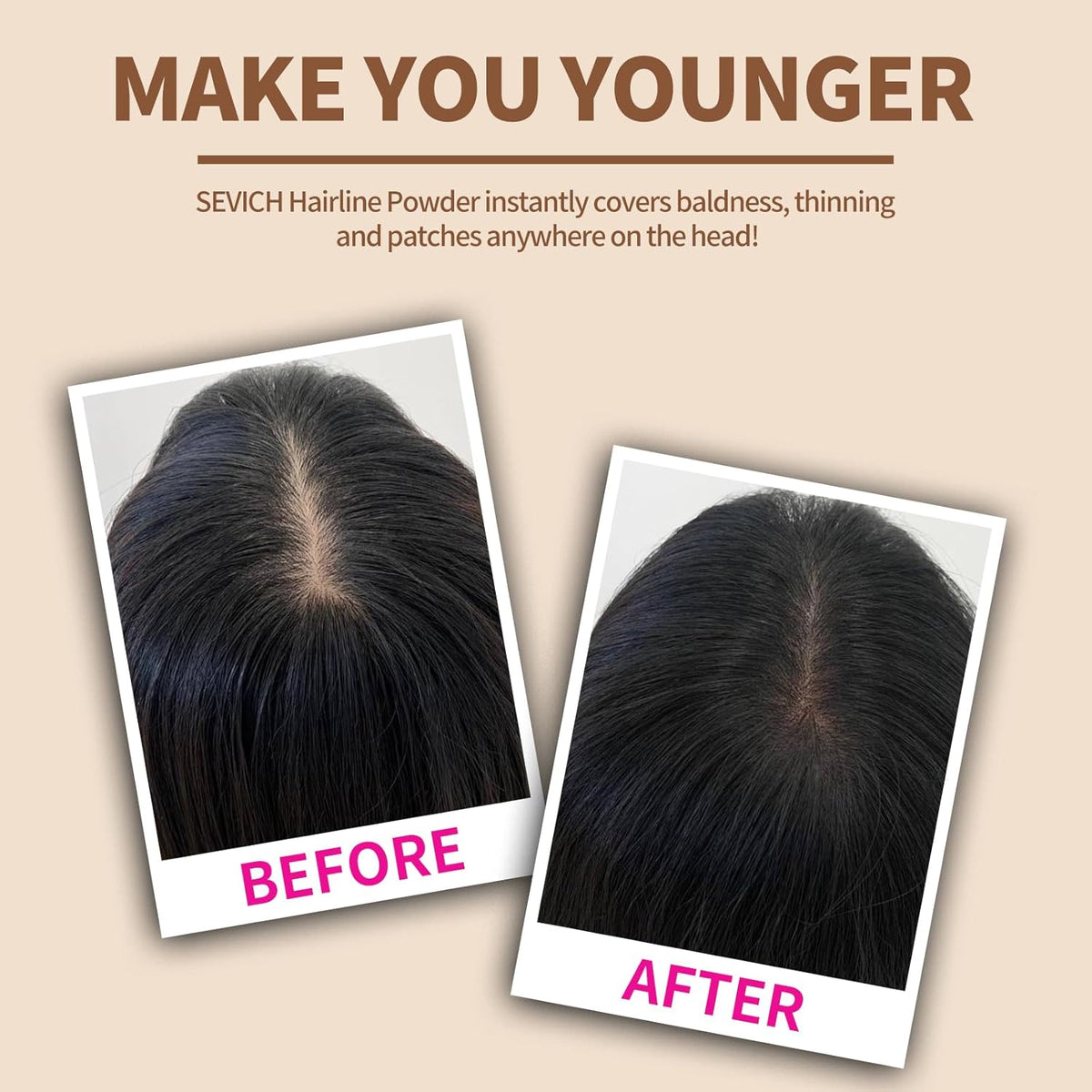 SEVICH Hairline Powder - Instantly Cover Grey Hair and Thinning Hairline, Eyebrows & Beard Line