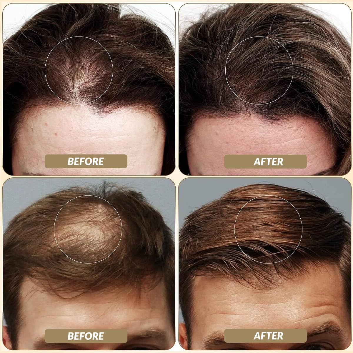 SOVONCARE Hair Fibers for Thinning Hair Auburn, Hair Building Fibers for Bald Spots Undetectable &