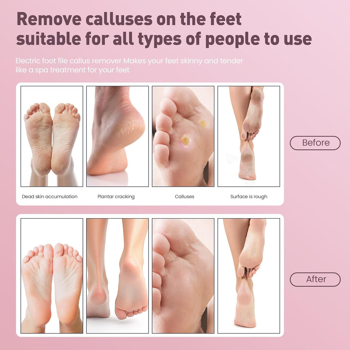 Electric Foot Callus Remover,2 in1 Rechargeable Callus Remover for Feet,9-Speed Wireless Electric