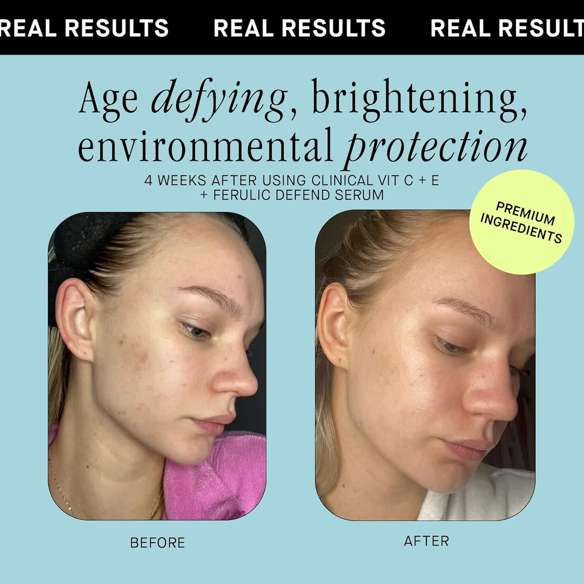 Brandefy Vitamin C Face Serum 15% L. Ascorbic Acid, Ferulic Acid .5% + Vitamin E for Self Care and