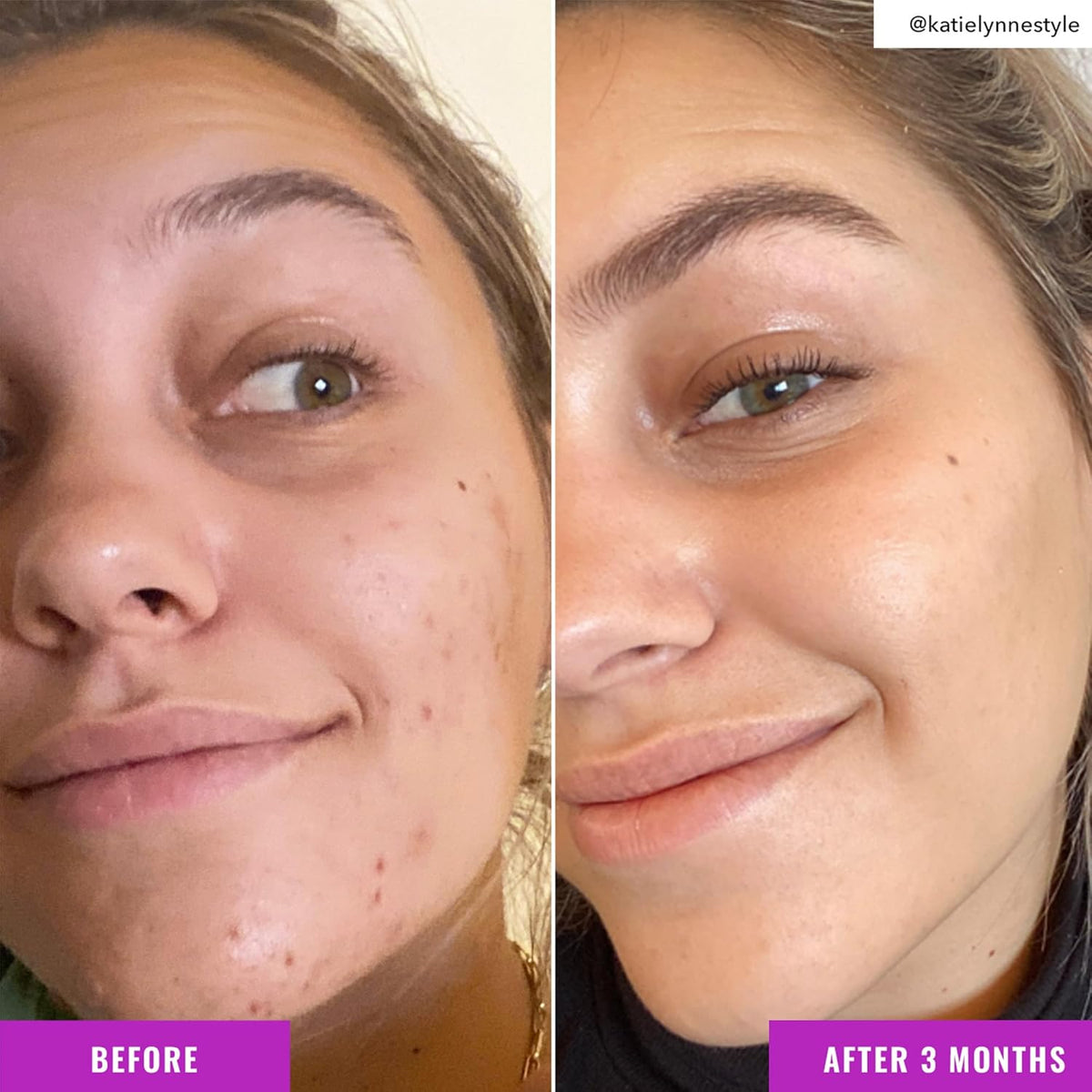 Good Molecules Niacinamide Brightening Toner - Toner for Face with Niacinamide and Arbutin for Skin