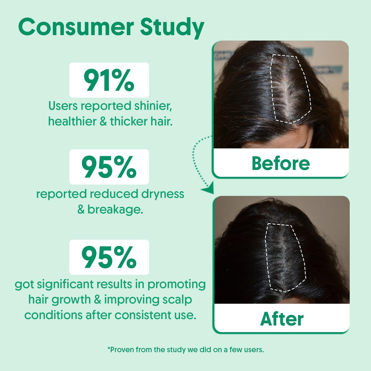 Rosemary Water Hair Spray For Hair Growth - Reducing Hair Fall, Strengthens Hair & Breakage