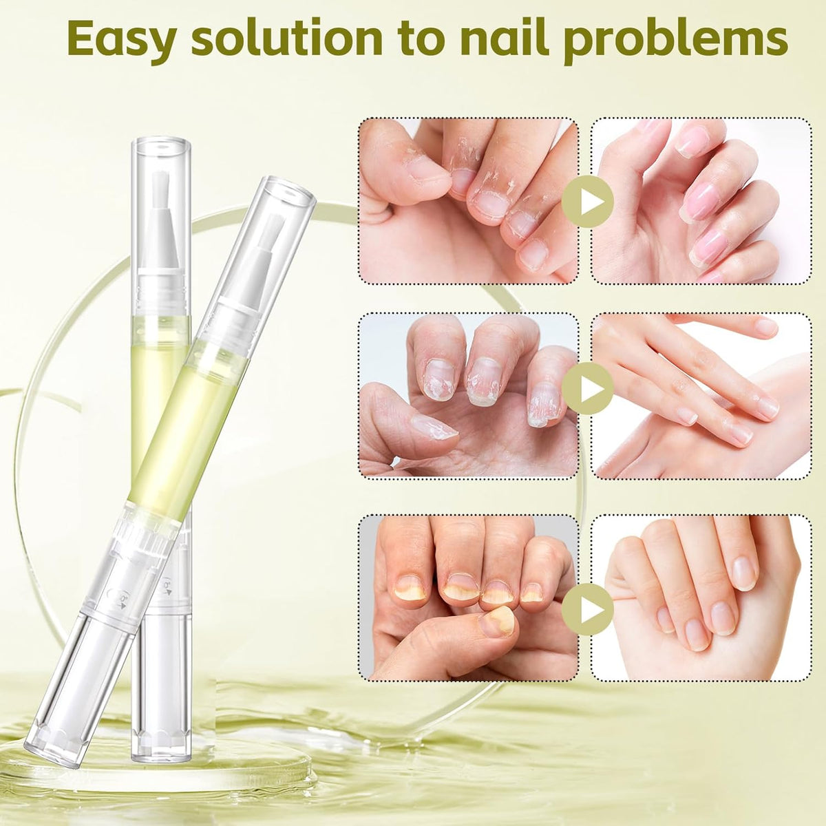 Nailz Nail 𝐆𝐫𝐨𝐰𝐭𝐡 Pen,Radiant Nail Growth GIL,Radiant Nail Growth Oil Pen,Cuticle Oil for