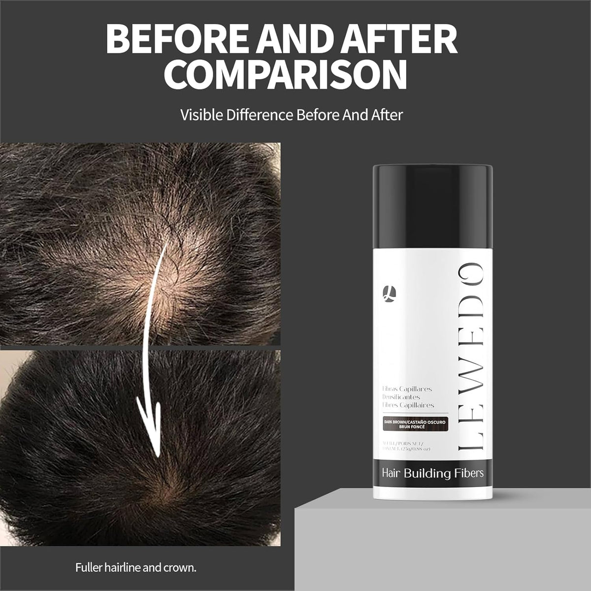 Hair Building Fibers - Instant Volume for Thinning Hair, Natural Appearance with Electrostatic