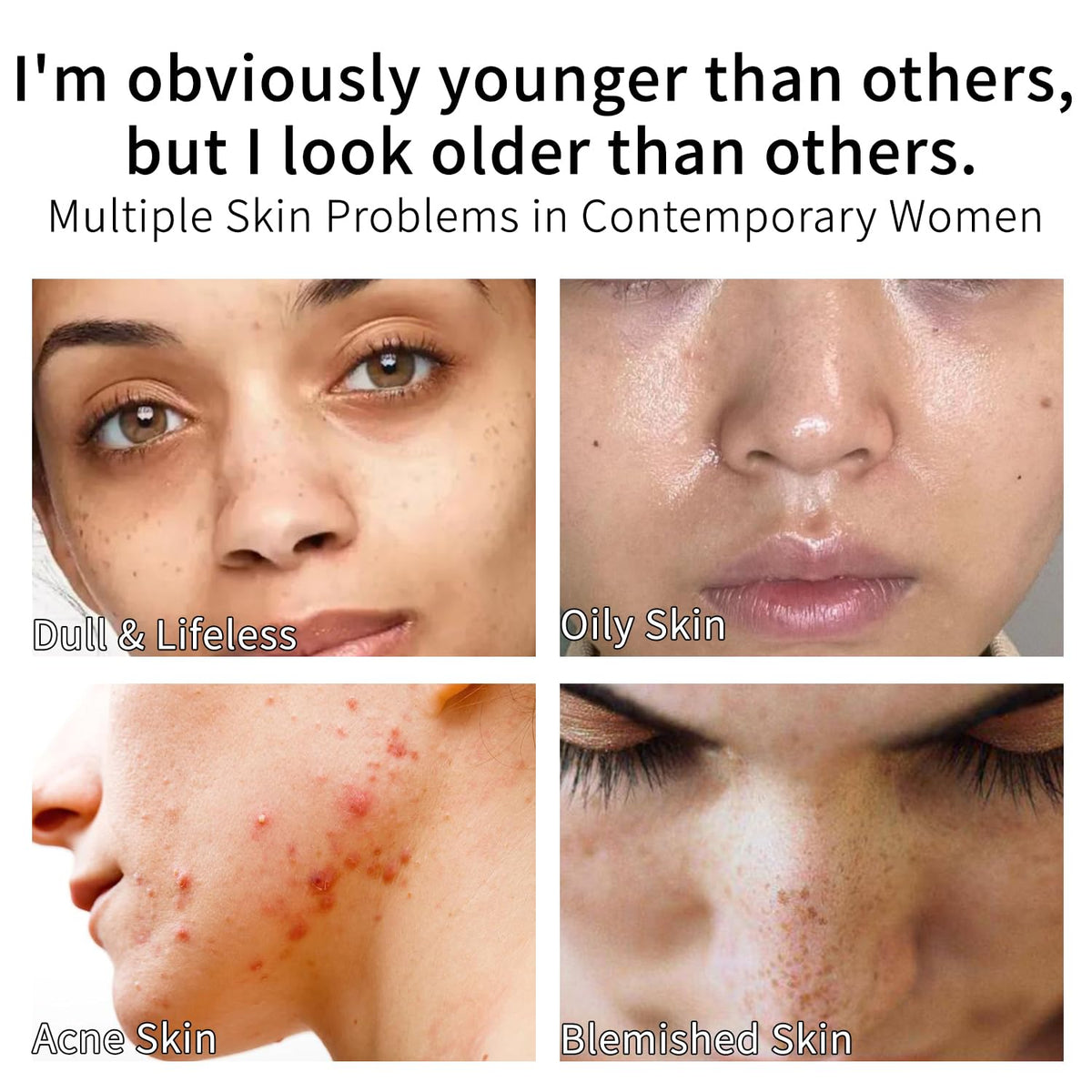Vitamin C Serum for Face with Vitamin E & Ferulic Acid, Smoothes Wrinkles,Improves Elasticity,Firms