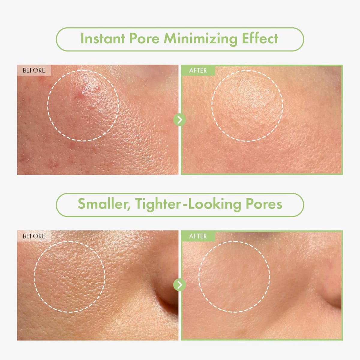 Green Caviar Pore Ampoule With 2,500ppm Green Caviar, Niacinamide, Pore Minimizer, Hydrating