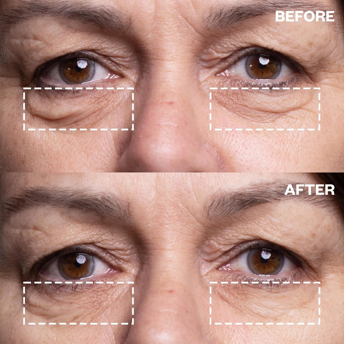 Wrinkles Schminkles Under Eye Wrinkle Starter Pack - Set of Reusable Under Eye Wrinkle Patches (3