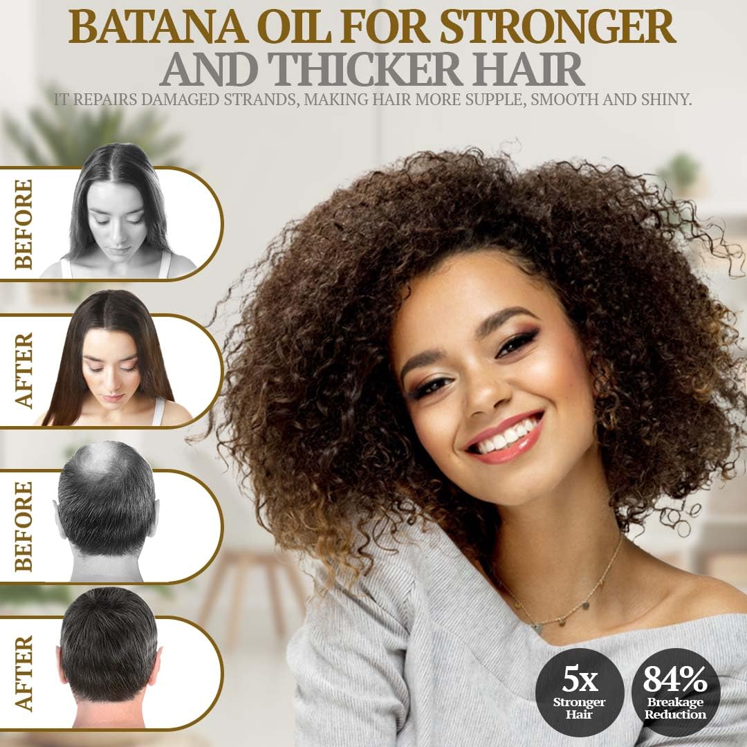 Batana Rosemary Oil For Hair Growth - Dr Sebi Organic Hair Growth Oil For Thickening, Deep