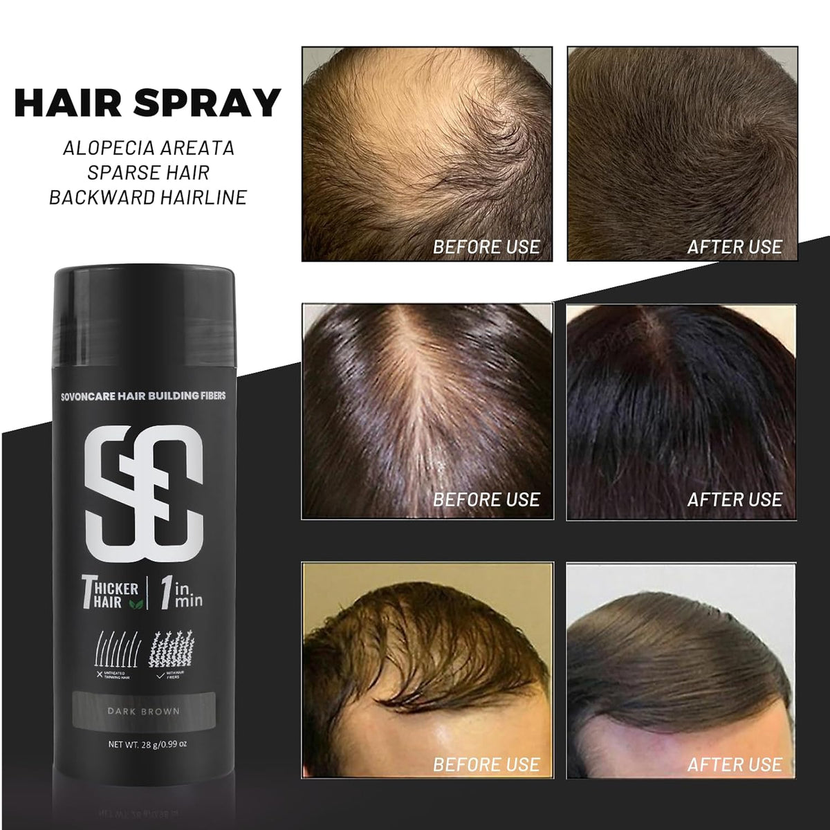 SOVONCARE Hair Fibers for Thinning Hair Dark Brown, Hair Building Fibers for Bald Spots