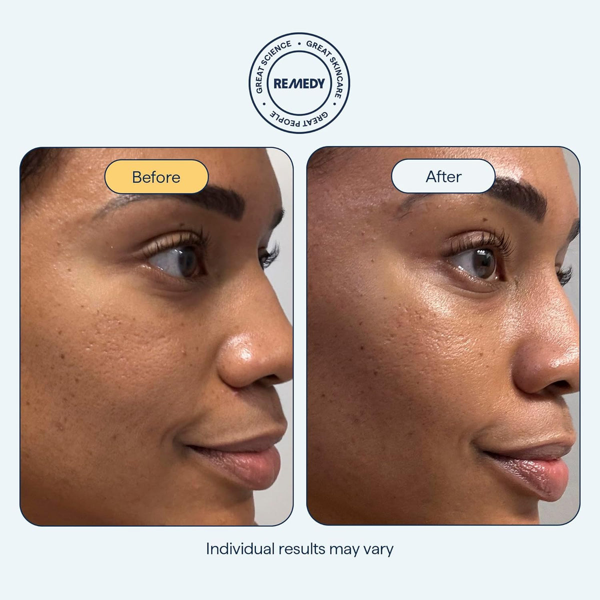 Remedy for Rich Moisture - Barrier Repairing Rich Cream Moisturizer for Normal to Dry Skin