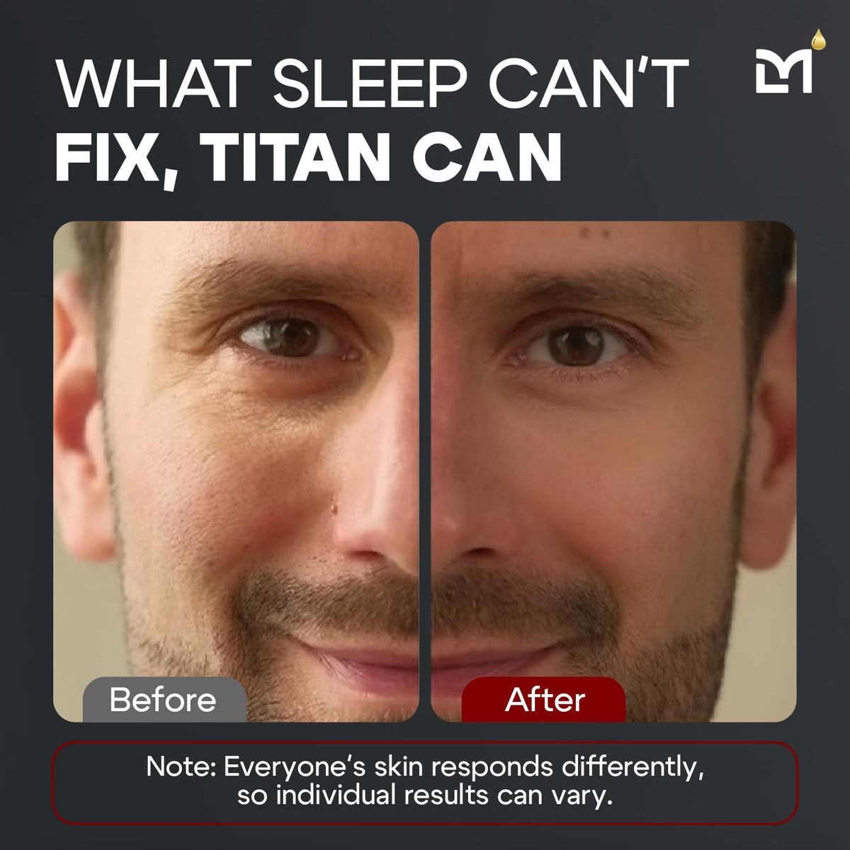 Titan Anti-Aging Mens Eye Cream – Mens Dark Circles Under Eyes Treatment – Eye Bags Treatment for