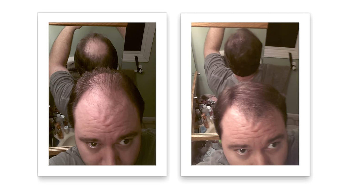 Caboki Hair Loss Concealer. Makes Thin Hair Look 10X Fuller Instantly. Eliminates Bald Spot and