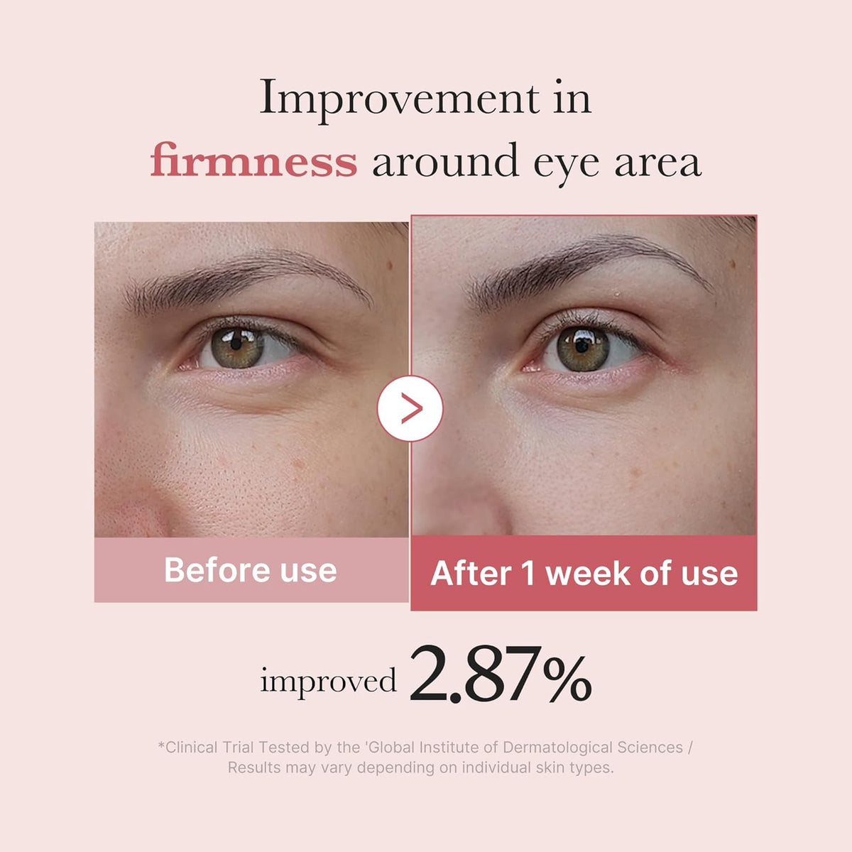 medicube Salmon DNA PDRN Pink Peptide Eye Serum with Niacinamide and 99% Purity Retinol for Fine