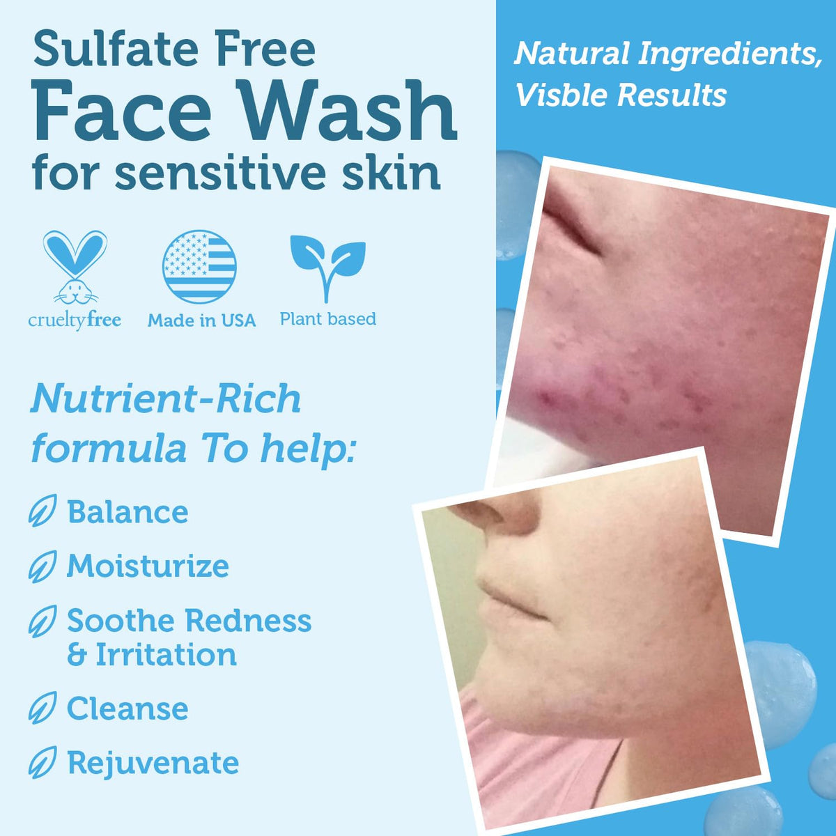 Era Organics Manuka Honey Face Wash for Women, Men - Sulfate Free Moisturizing Cleanser, Organic