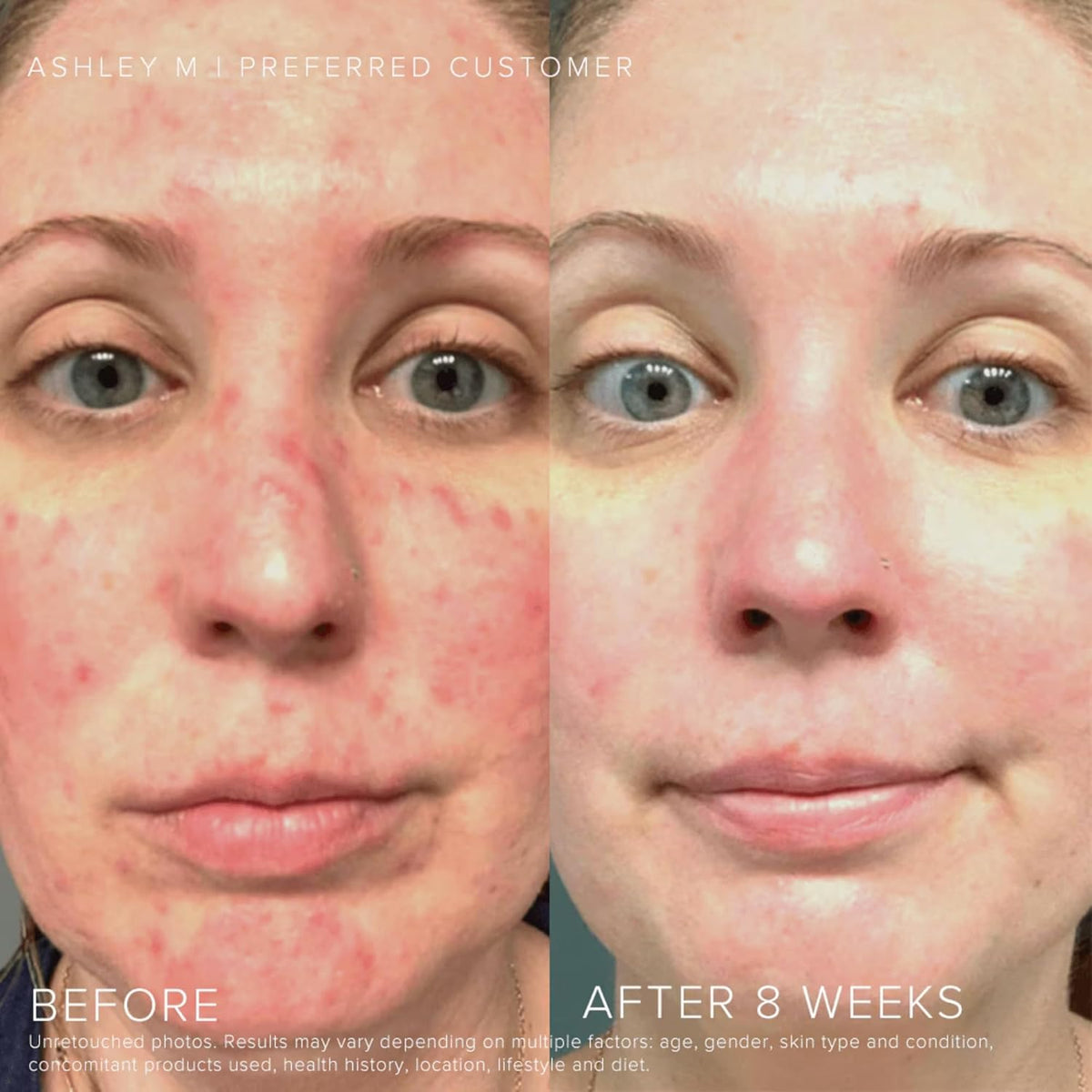 Rodan + Fields Soothe Daily Mineral Sunscreen SPF 30 | 1 Fl Oz | SPF Moisturizer for Face | Zinc