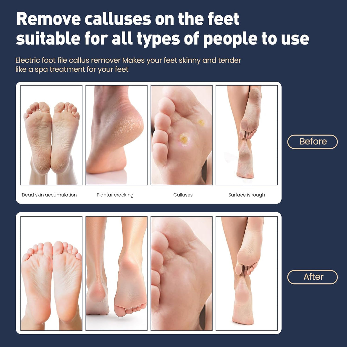 Electric Foot Callus Remover,2 in1 Rechargeable Callus Remover for Feet,9-Speed Wireless Electric