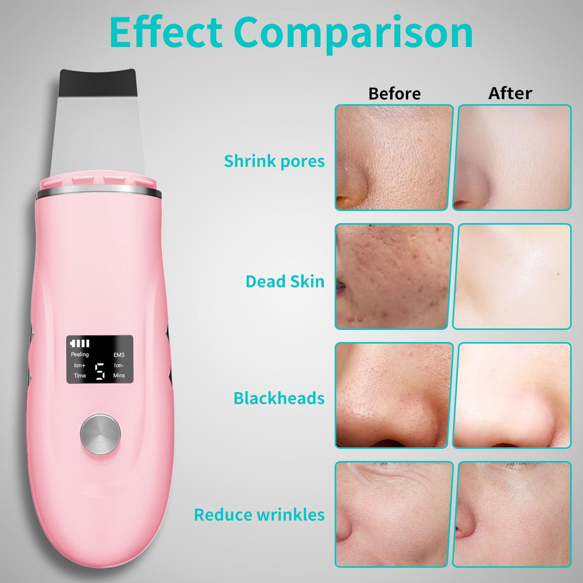 Face Scrubber Skin Spatula - Blackhead Remover Deep Cleansing Tool for Pore Extraction, 4-in-1 Fast