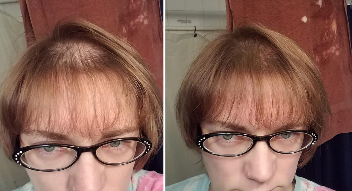 Caboki Hair Loss Concealer. Makes Thin Hair Look 10X Fuller Instantly. Eliminates Bald Spot and