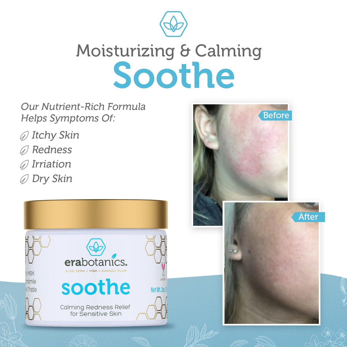 Era Organics Cream Redness Relief Moisturizer- Soothing Redness Relief for Face with Manuka Honey