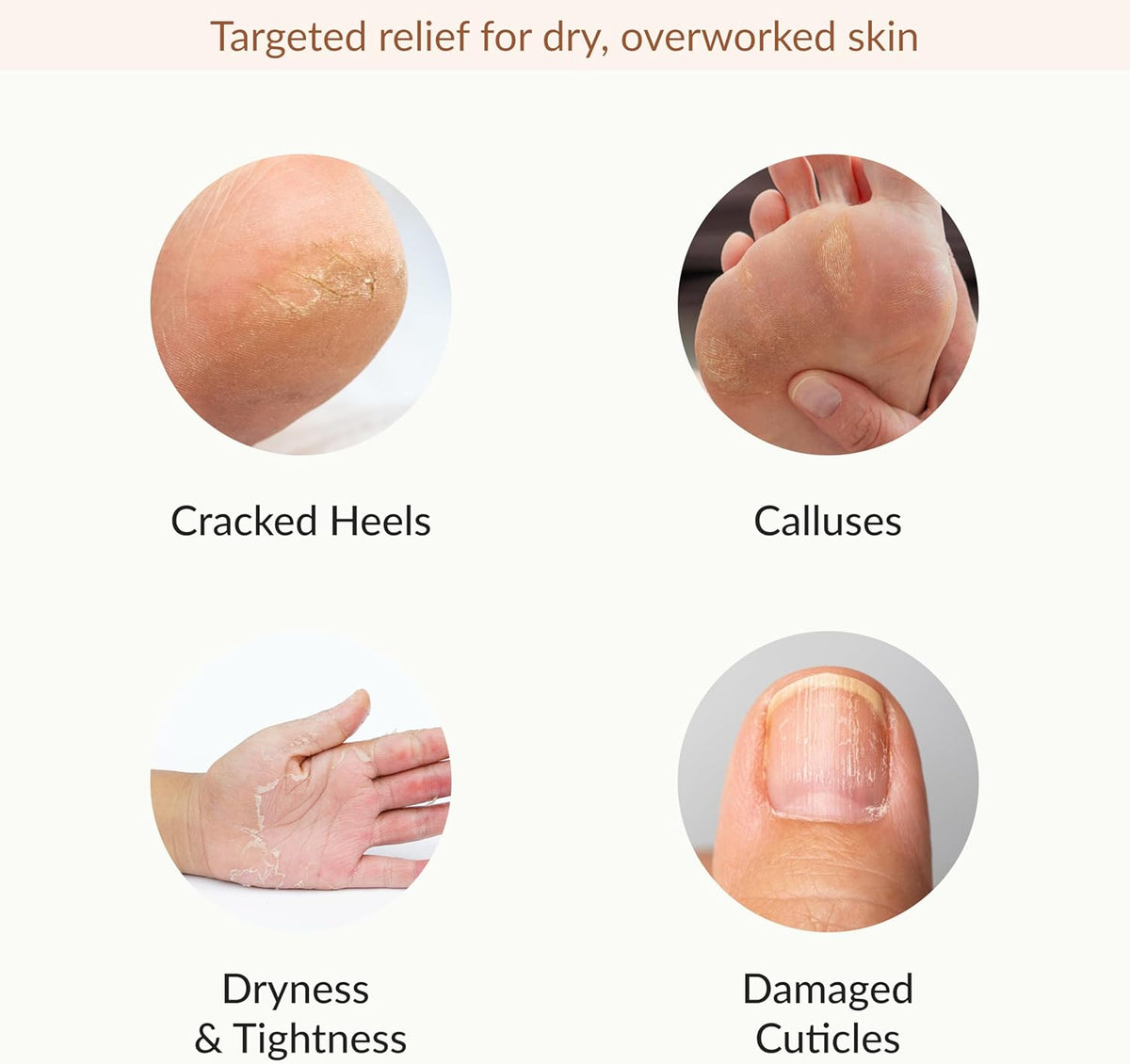 Epielle Hydrating & Moisturizing Hand & Foot Masks 12 Pairs, Relieve and Soften Dry Hands & Cracked
