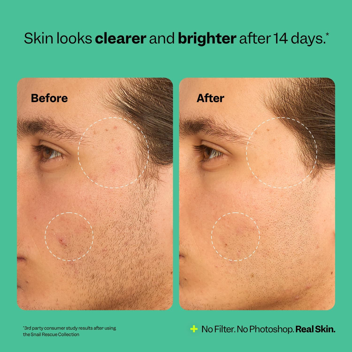 Peach Slices | Snail Rescue Blemish Busting Toner | 95% Snail Mucin | Pore Cleaner | Hydrates &