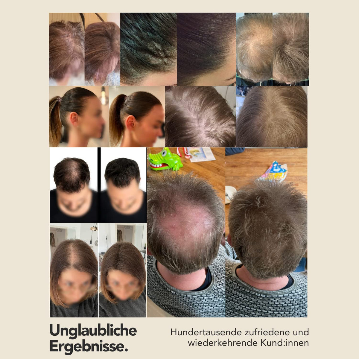 IMPERIO Hair Building Fibers for Thinning Hair - 26g Premium Hair Fibers for Women & Men in