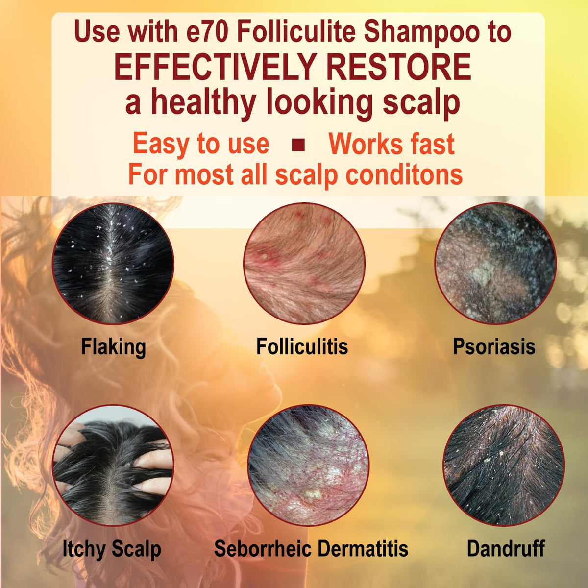 Folliculitis Treatment Conditioner with 3% BHA, Salicylic Acid, Tea Tree Oil & Chamomile Extracts