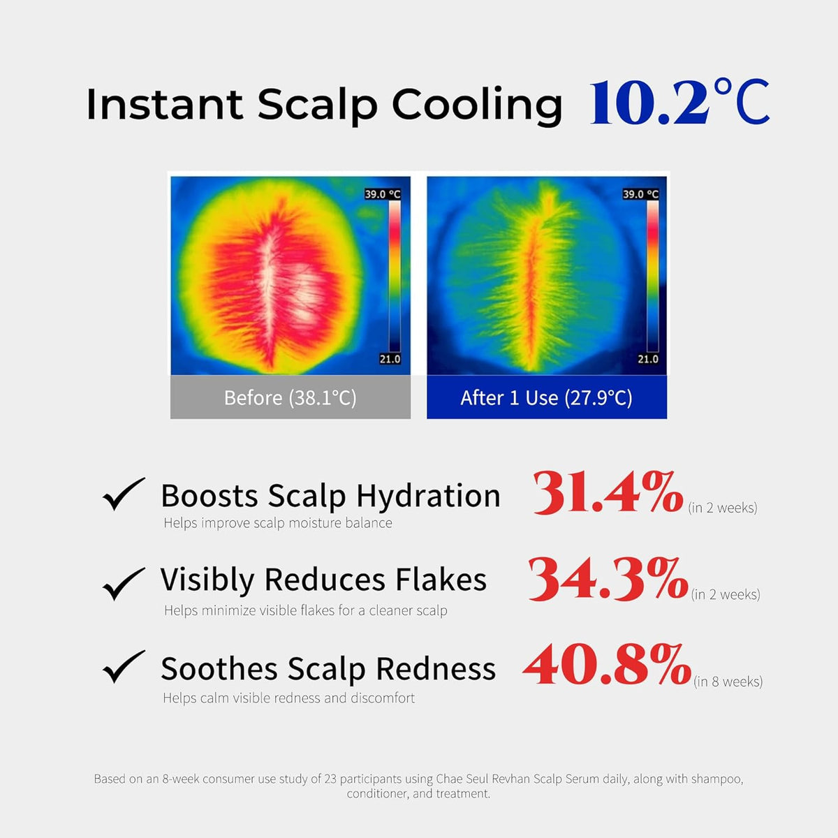 Revhan Scalp Serum for Hair Loss & Thinning – Hair Growth Serum for Men & Women w/Salicylic Acid &